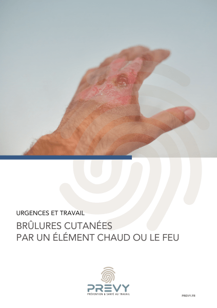 PREVY BRULURES CUTANEES PAR UN ELEMENT CHAUD OU LE FEU - - Livret PREVY - brûlures cutanées par un élément chaud ou le feu - PREVY Prévention & Santé au Travail